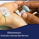 Eletroneuro