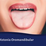 Distonia Oromandibular