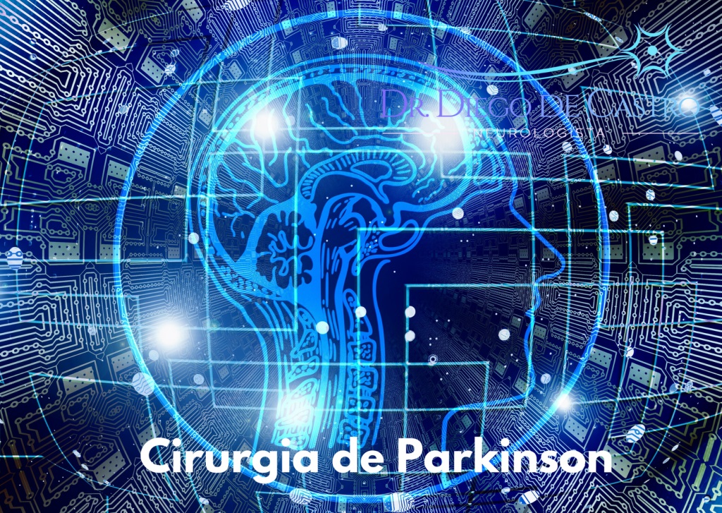 Cirurgia para Doença de Parkinson