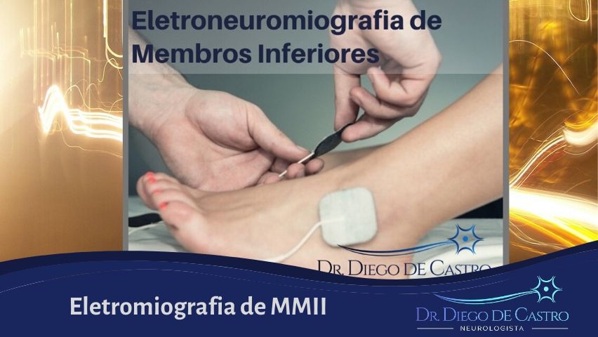 Eletromiografia de MMII - Exame dos Nervos das Pernas e Coluna Lombar
