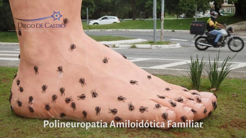 Polineuropatia amiloidótica familiar - Blog Mendelics