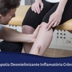 Polineuropatia Inflamatória Desmielinizante Crônica