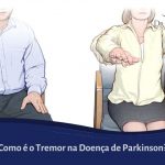 Tremor no Parkinson