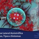 Esclerose Lateral Amiotrófica