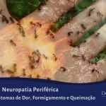 Neuropatia Periférica