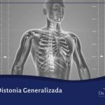Distonia Generalizada