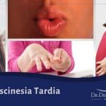 discinesia tardia