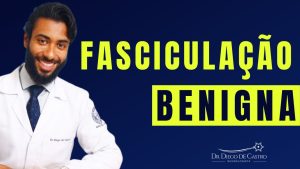 Fasciculação Benigna