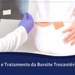 Tratamento da Bursite Trocantérica