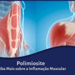 Polimiosite